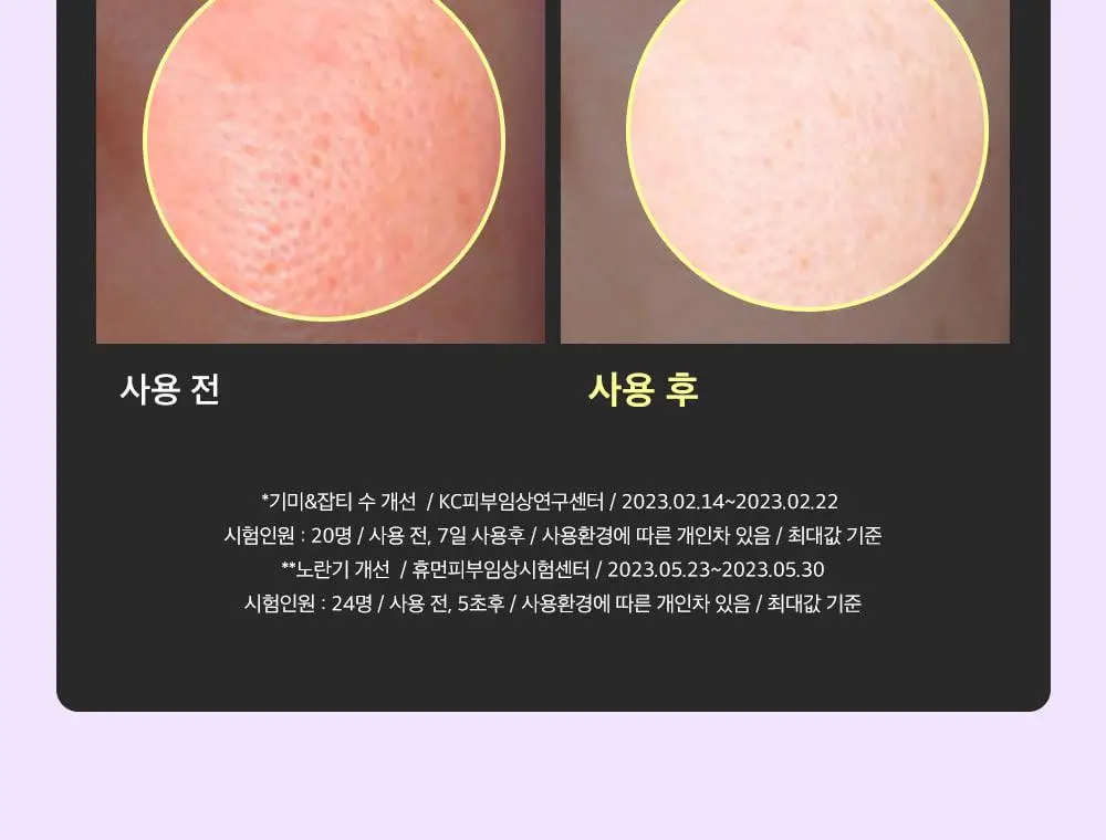 [포켓몬 에디션/잡티미백]성분에디터 머루포도 비타씨 다크 스팟 앰플 40ml 더블기획* 상세페이지 15